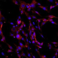 人骨髓间充质干细胞