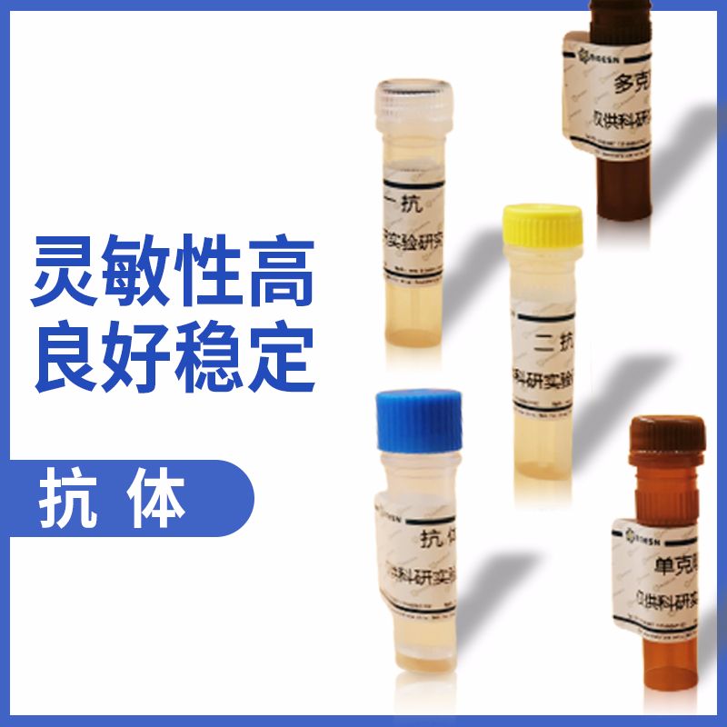 GM130 Rabbit Polyclonal Antibody产品图