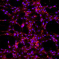 大鼠肺大动脉内皮细胞
