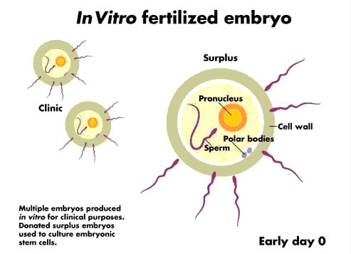 什么是干细胞?干细胞适应症有哪些？