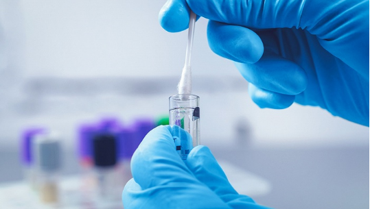 红螯光壳螯虾卵黄脂磷蛋白（Lv/Vn）elisa试剂盒现货临床样本的收集