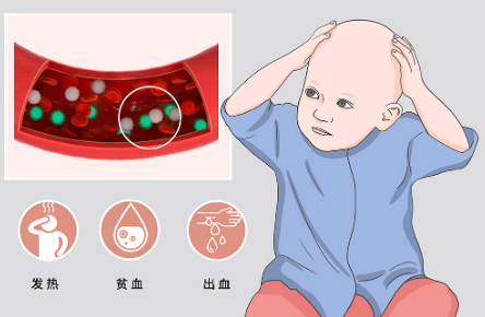 儿童白血病一起来剖析