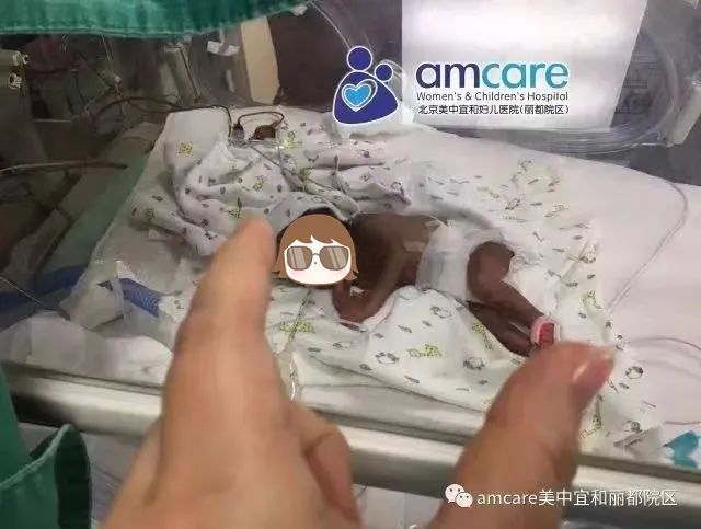 美中宜和丽都院区新生儿科：那些曾经从死神手里「抢」回来的孩子们，现在还好吗？