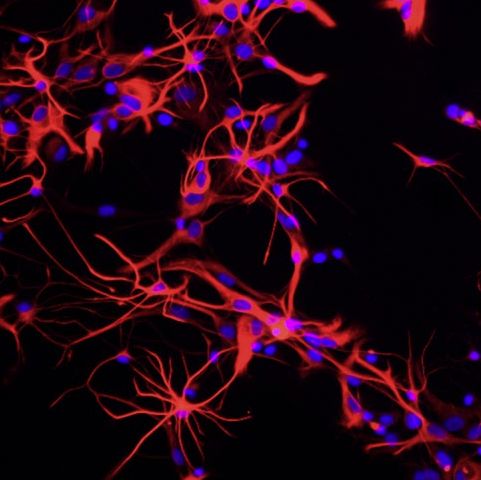 大鼠神经星形胶质细胞