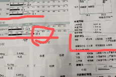 看起来「瘦」的多囊姐妹，体内藏着多少你看不到的脂肪？