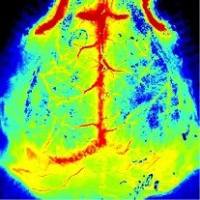激光散斑血流成像系统