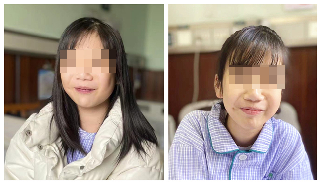 「小紫人」变回正常人！12 岁女孩两次「补心」重返校园