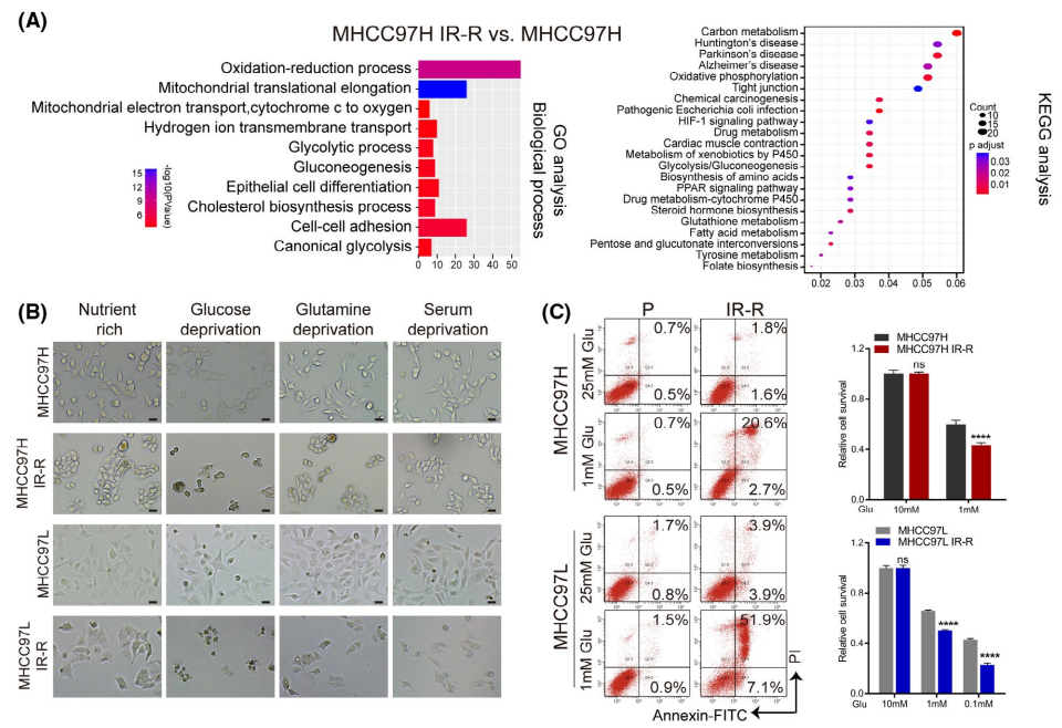 IF 17.4 | 代谢流与脂质组手段探究肝癌细胞抗放疗真相