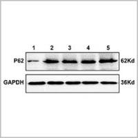 Western Blot
