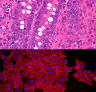 解析免疫组化（IHC）实验步骤和注意事项
