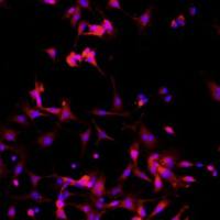 小鼠Ⅱ型肺泡上皮细胞