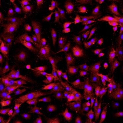 小鼠肺微血管内皮细胞