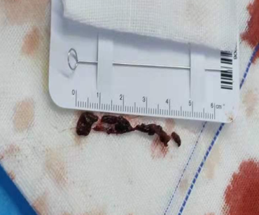 这种软绵绵的东西是夺命真凶！无数人因它死亡而一无所知！
