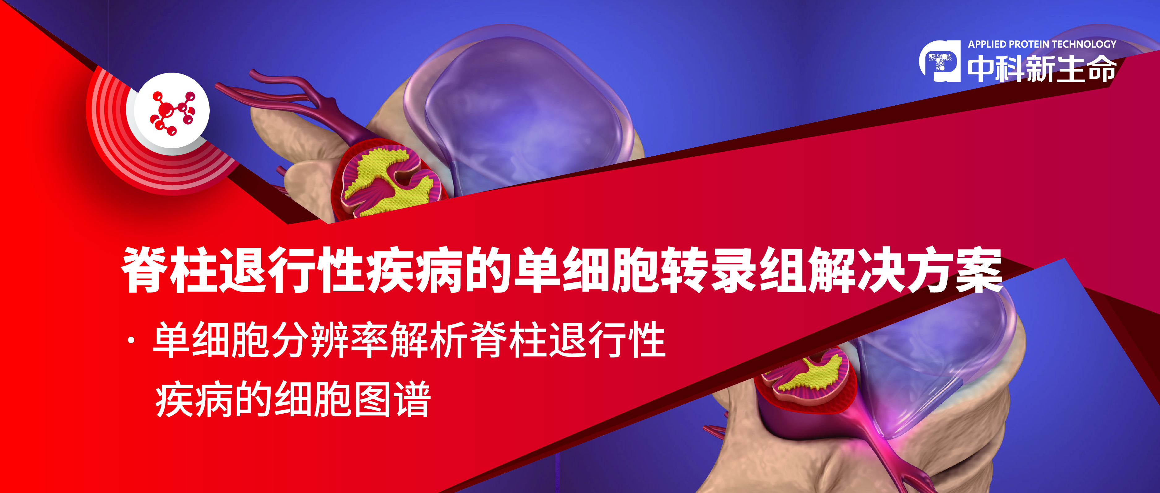 Advance Science(IF 16.8) | 单细胞分辨率解析脊柱退行性疾病的细胞图谱