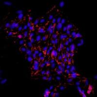 小鼠肺大动脉内皮细胞