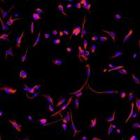 小鼠心肌成纤维细胞