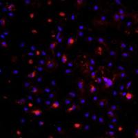 小鼠肝枯否细胞