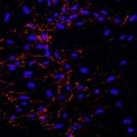 小鼠脑微血管内皮细胞