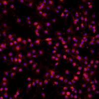 小鼠骨髓来源巨噬细胞