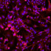 小鼠海绵体内皮细胞