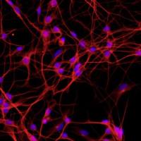 小鼠背根神经元细胞