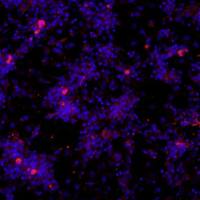 小鼠真皮微血管内皮细胞