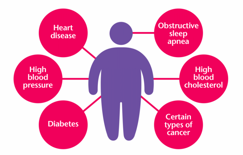 集萃药康饮食诱导肥胖模型-DIO小鼠