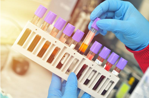 ELISA实验样本处理方法