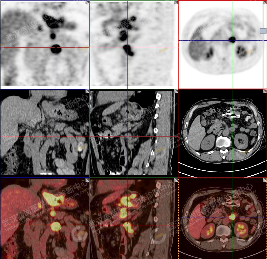 图23-4 经胃贲门的MRI横断层图像-外科学-医学