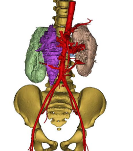 与死神抗争,在刀尖上跳舞,多学科协作救治 5 岁患癌男孩