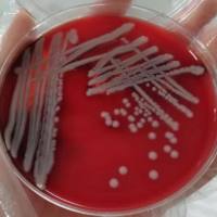 Cary-Blair氏运送培养基