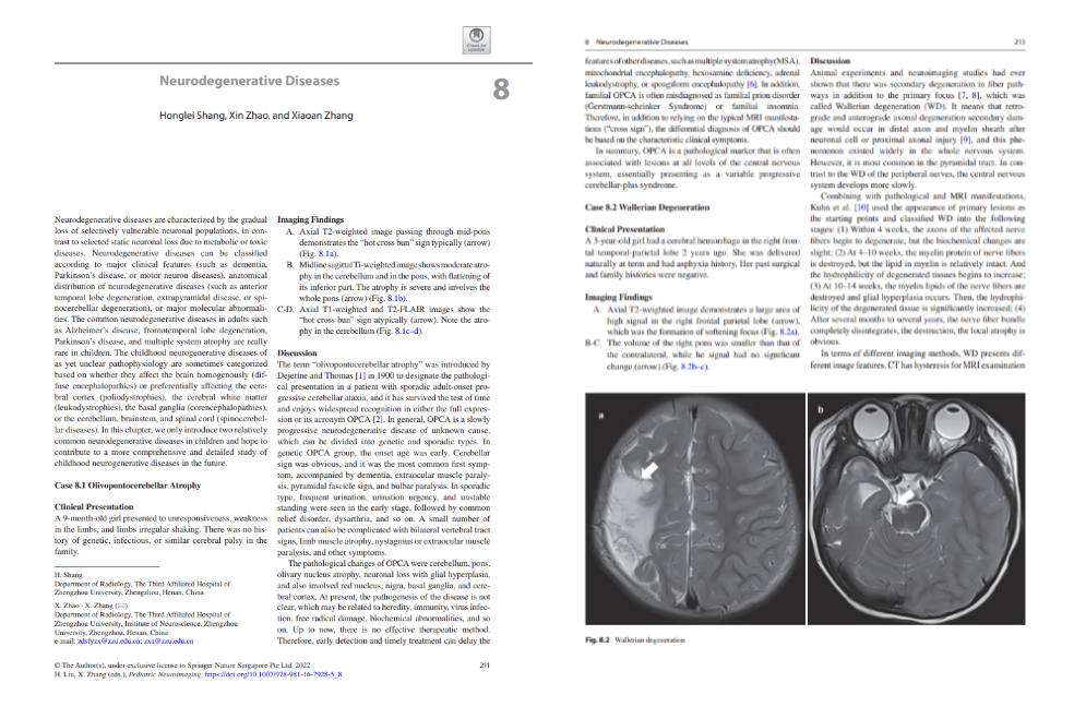 郑大三附院（河南省妇幼保健院）医学影像科团队主编的《Pediatric  Neuroimaging》一书正式出版