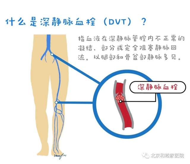 疫情期间，那些等不得的血管病急症
