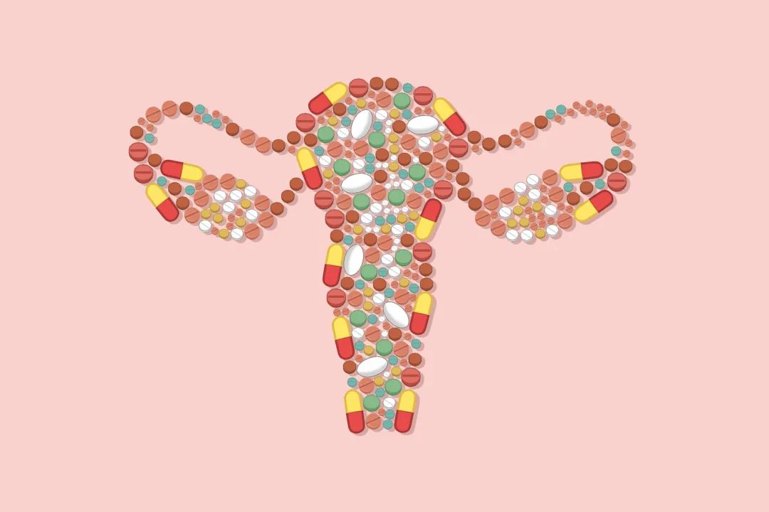 内异症患者要警惕卵巢癌