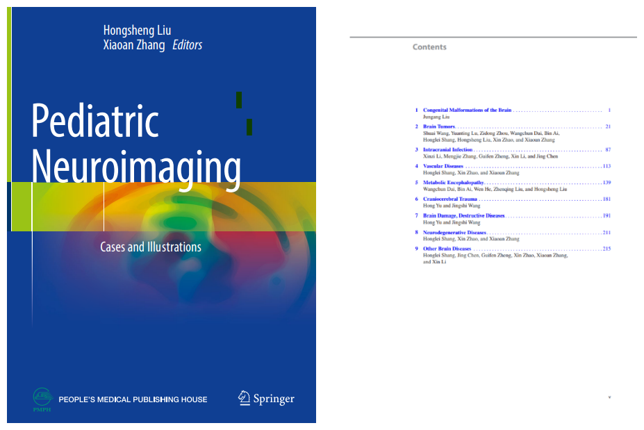 郑大三附院（河南省妇幼保健院）医学影像科团队主编的《Pediatric  Neuroimaging》一书正式出版