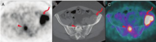 常州市第二人民医院：PET-CT 检查大揭秘