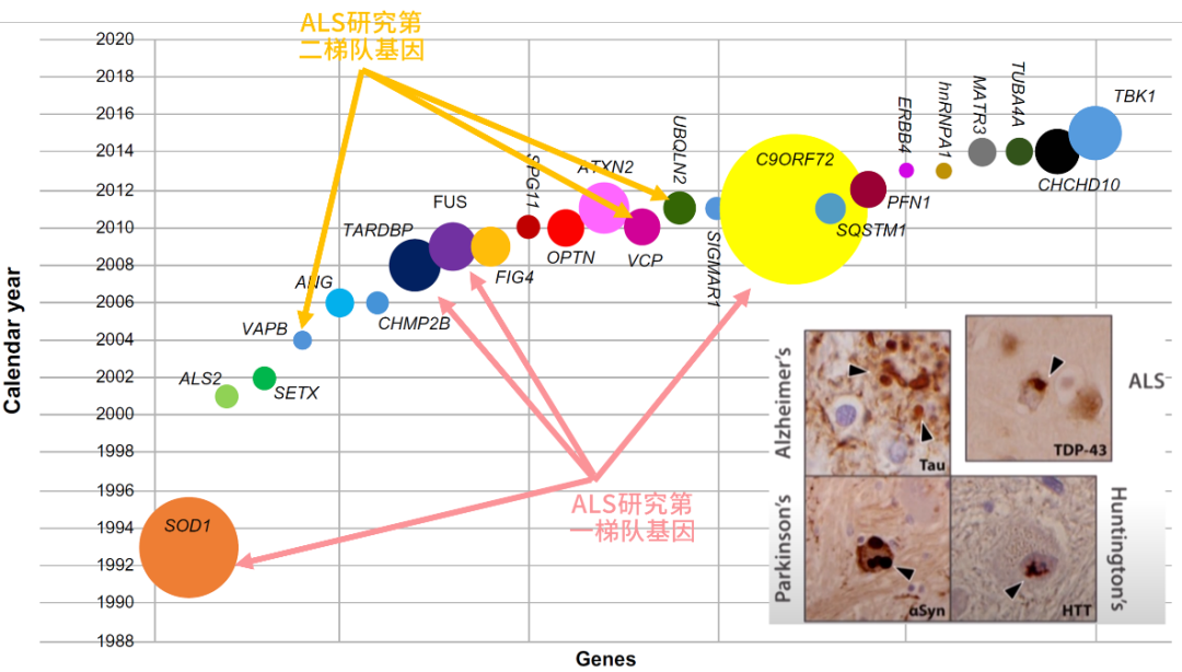 【罕见病并不罕见】原来ALS肌萎缩侧索硬化症的致病元凶竟是……