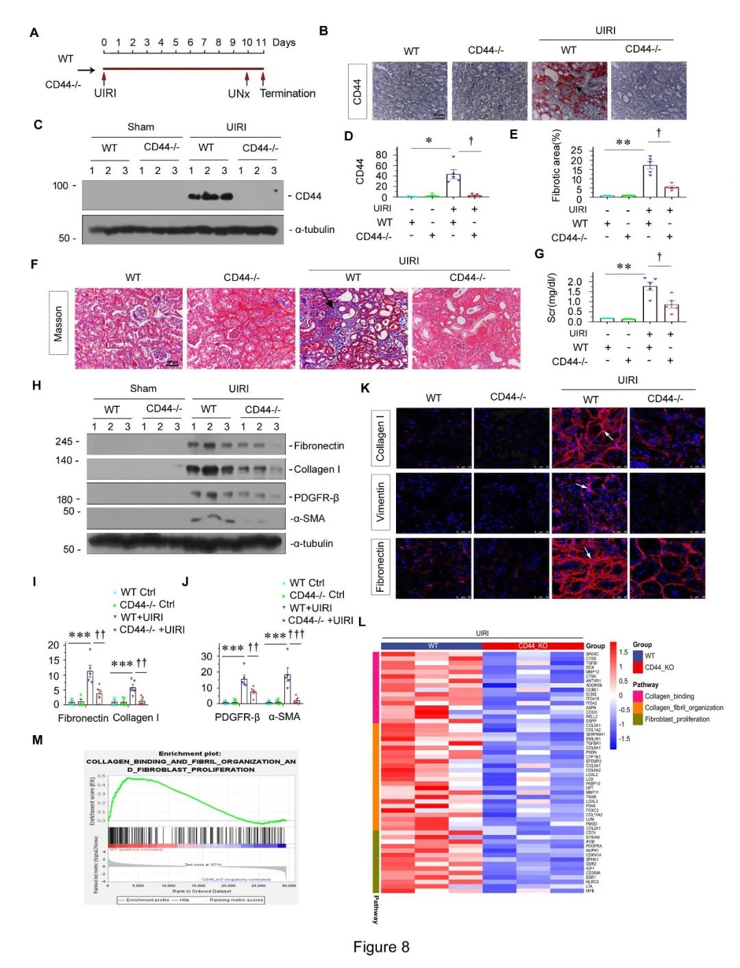 南方医科大学周丽丽团队揭示肾纤维化新机制