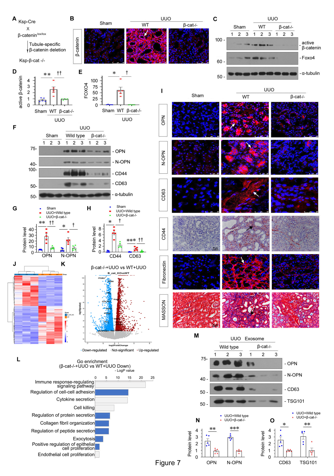 南方医科大学周丽丽团队揭示肾纤维化新机制