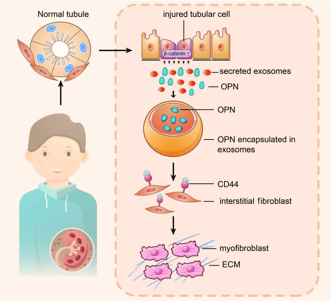 南方医科大学周丽丽团队揭示肾纤维化新机制