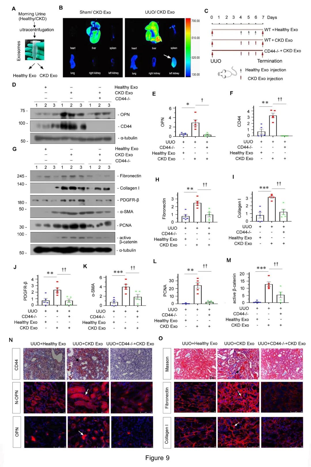 南方医科大学周丽丽团队揭示肾纤维化新机制