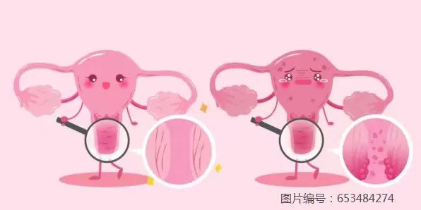 与女性生殖健康息息相关的宫颈疾病，每日小知识 get！