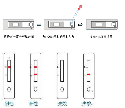 LP军团菌尿抗原检测卡
