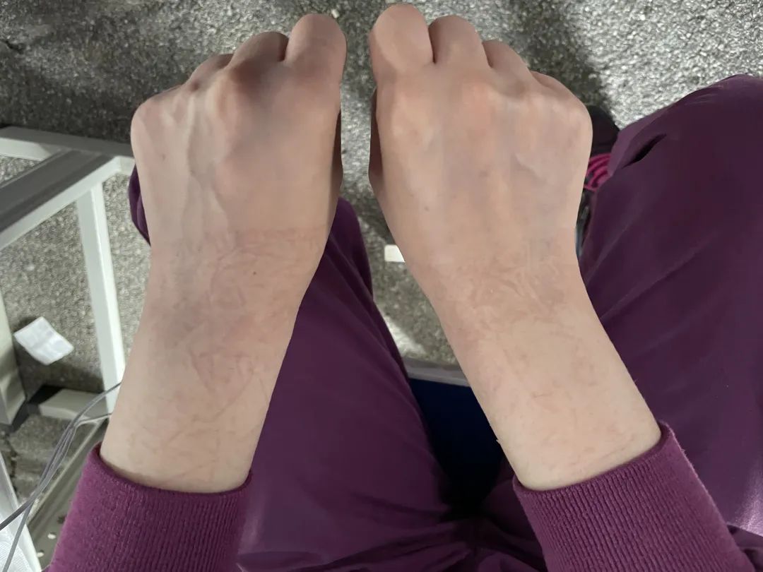 放下「银针」持拭子 白衣执甲战疫情——记疫情防控中的针灸科