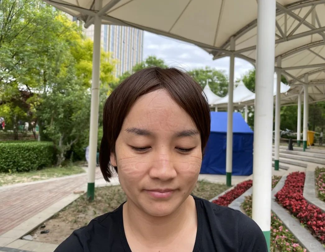 放下「银针」持拭子 白衣执甲战疫情——记疫情防控中的针灸科