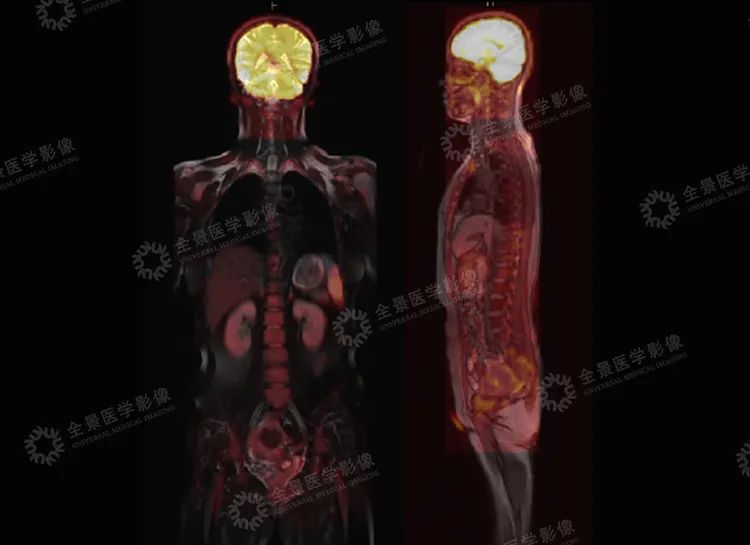 疫情打乱了生活节奏，你的身体还健康吗？