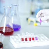 一管式病毒RNA提取试剂盒