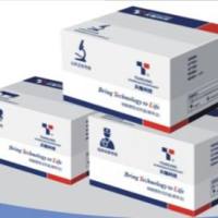 EB病毒核酸检测试剂盒(荧光PCR法)