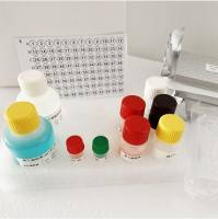 人嗜酸粒细胞趋化蛋白Eotaxin 3(Eotaxin 3/CCL26)ELISA检测试剂盒