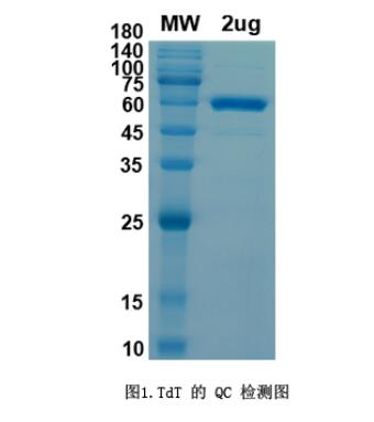 Terminal Deoxynucleotidyl Tran